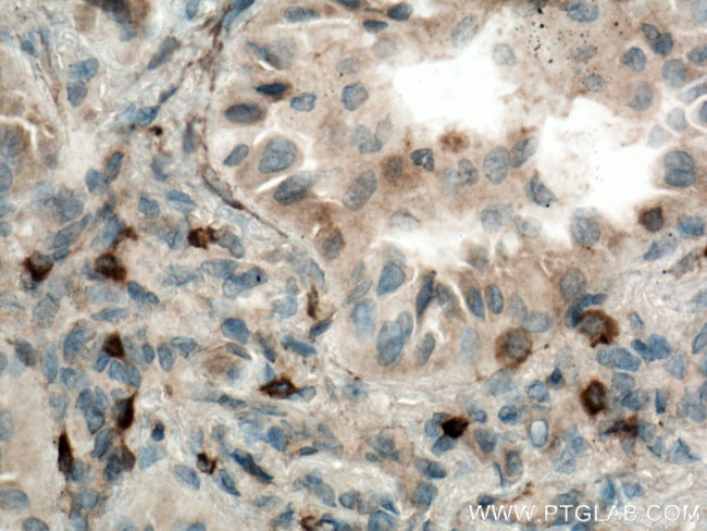 KRAS Antibody in Immunohistochemistry (Paraffin) (IHC (P))