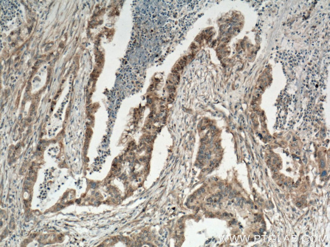 KRAS Antibody in Immunohistochemistry (Paraffin) (IHC (P))