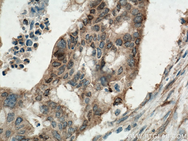 KRAS Antibody in Immunohistochemistry (Paraffin) (IHC (P))