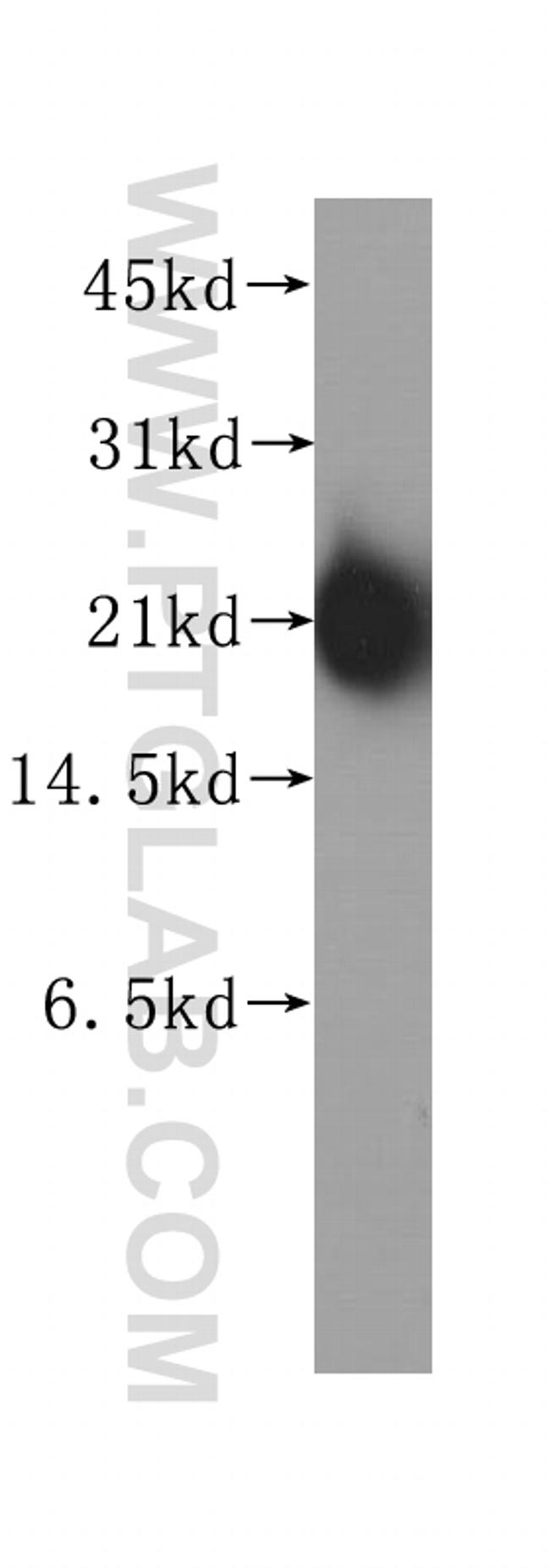 KRAS Antibody in Western Blot (WB)