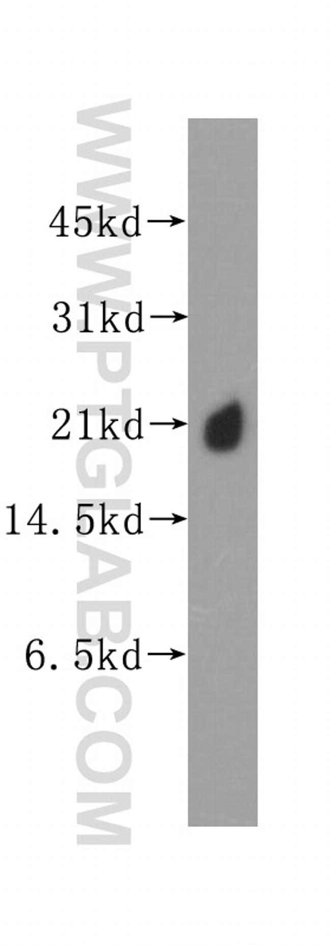 KRAS Antibody in Western Blot (WB)