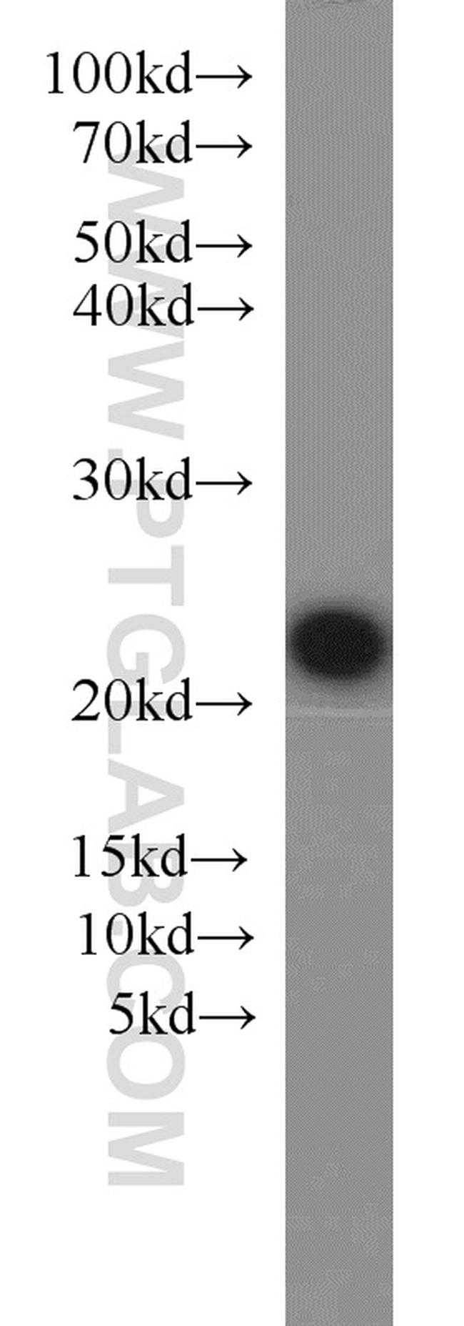 KRAS Antibody in Western Blot (WB)