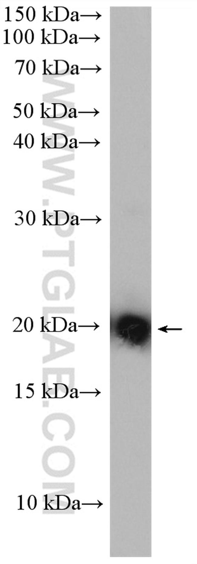 KRAS Antibody in Western Blot (WB)