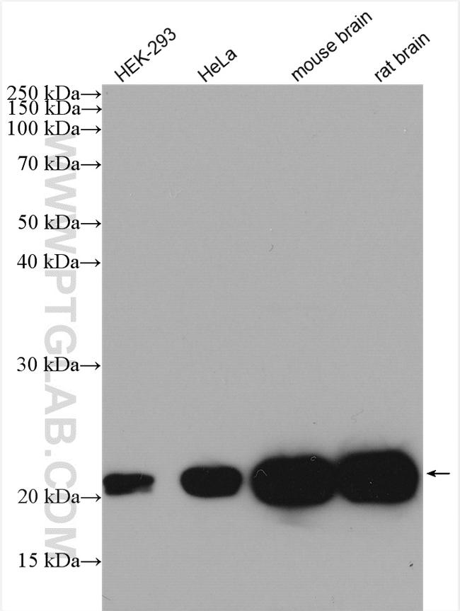 KRAS Antibody in Western Blot (WB)