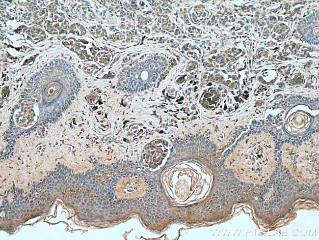 IL-24 Antibody in Immunohistochemistry (Paraffin) (IHC (P))