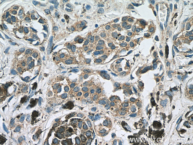 IL-24 Antibody in Immunohistochemistry (Paraffin) (IHC (P))