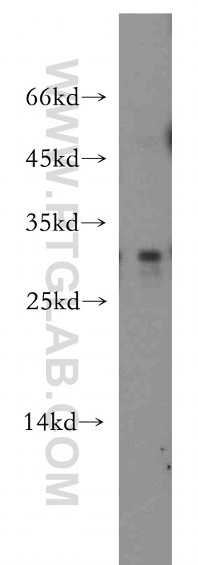 IL-24 Antibody in Western Blot (WB)