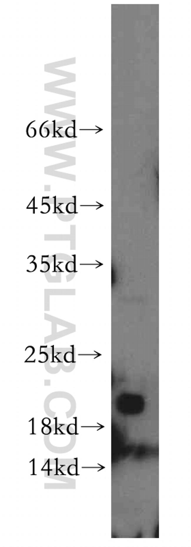 NBL1 Antibody in Western Blot (WB)