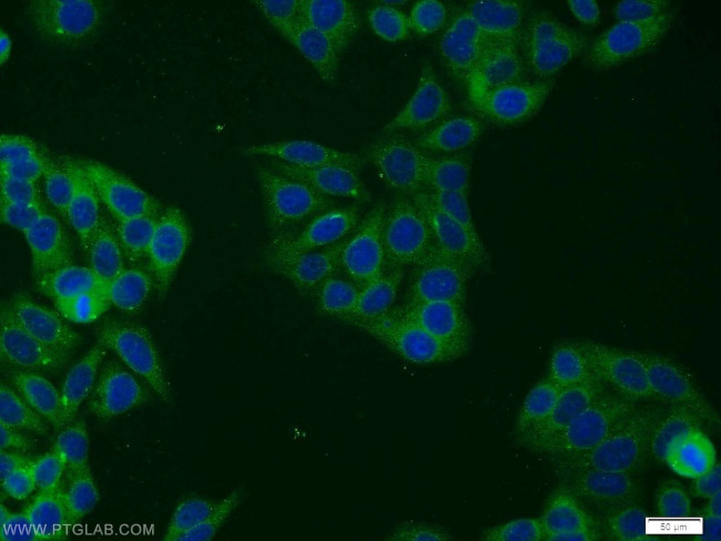 STAT5B Antibody in Immunocytochemistry (ICC/IF)