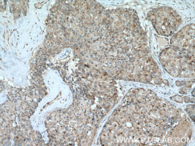 STAT5B Antibody in Immunohistochemistry (Paraffin) (IHC (P))