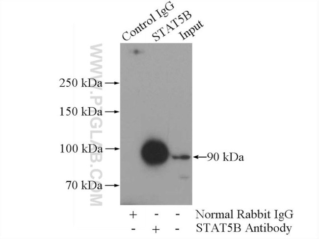 STAT5B Antibody in Immunoprecipitation (IP)