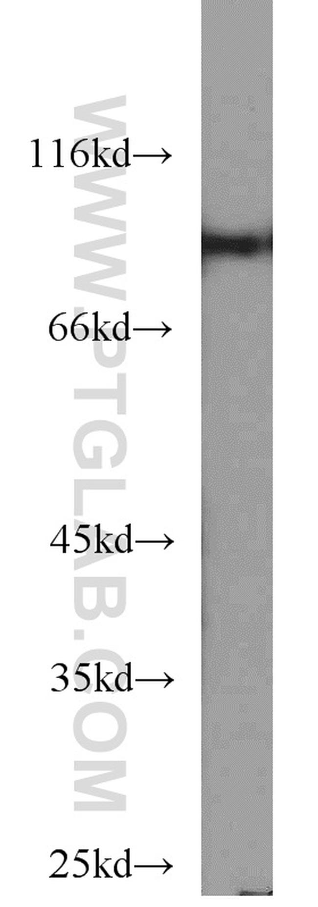 STAT5B Antibody in Western Blot (WB)