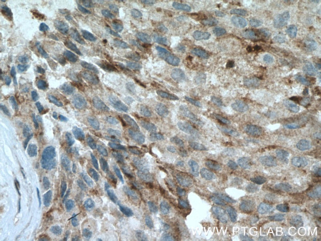 STAT5B Antibody in Immunohistochemistry (Paraffin) (IHC (P))