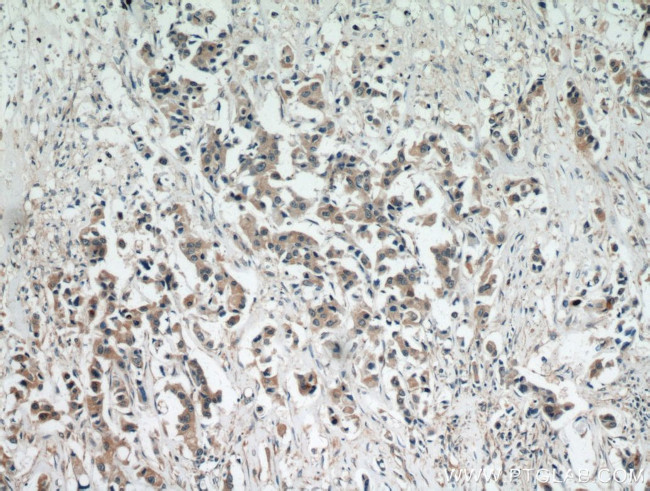 STAT5B Antibody in Immunohistochemistry (Paraffin) (IHC (P))