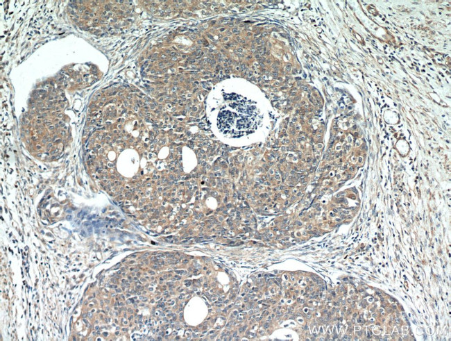 STAT5B Antibody in Immunohistochemistry (Paraffin) (IHC (P))