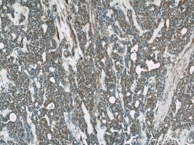 STAT5B Antibody in Immunohistochemistry (Paraffin) (IHC (P))