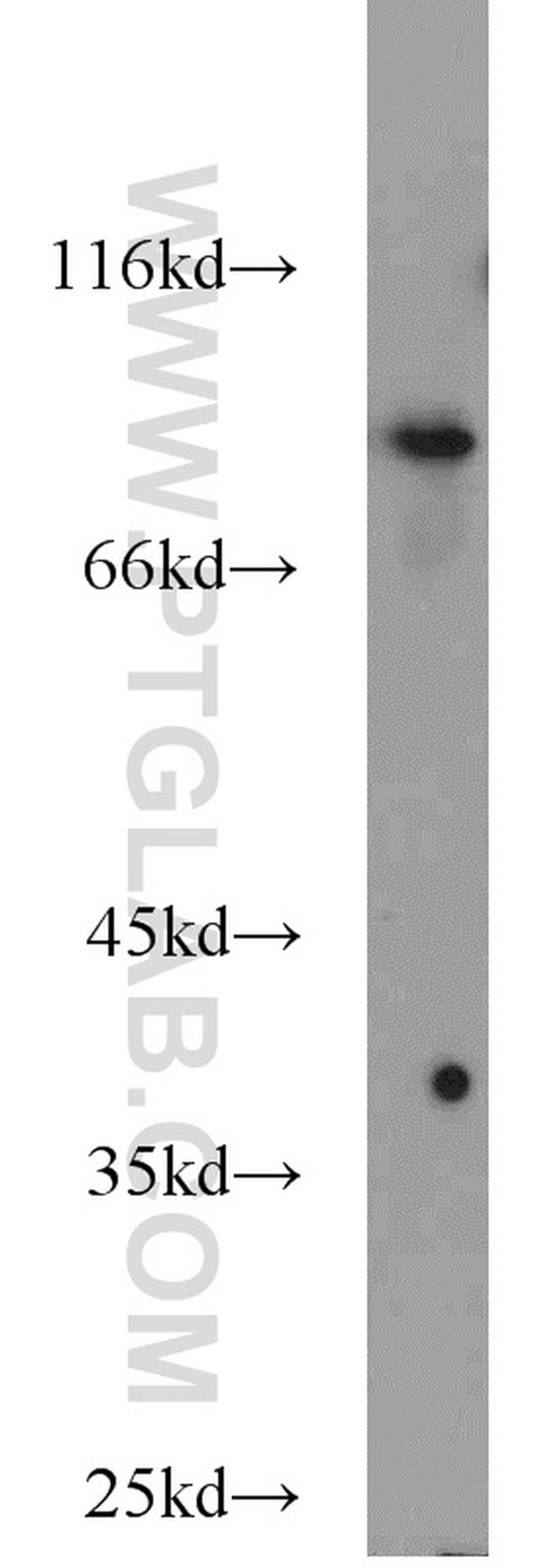 STAT5B Antibody in Western Blot (WB)