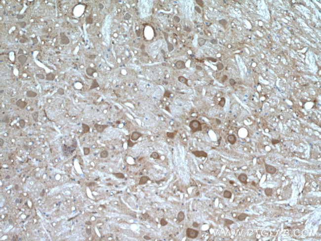 PYGB Antibody in Immunohistochemistry (Paraffin) (IHC (P))