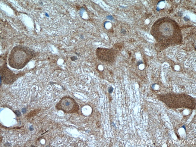 PYGB Antibody in Immunohistochemistry (Paraffin) (IHC (P))