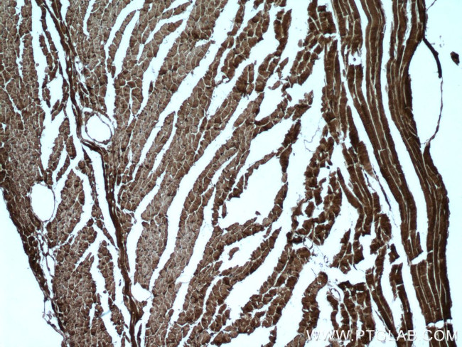 PYGB Antibody in Immunohistochemistry (Paraffin) (IHC (P))