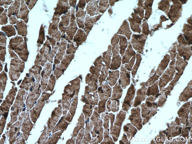 PYGB Antibody in Immunohistochemistry (Paraffin) (IHC (P))