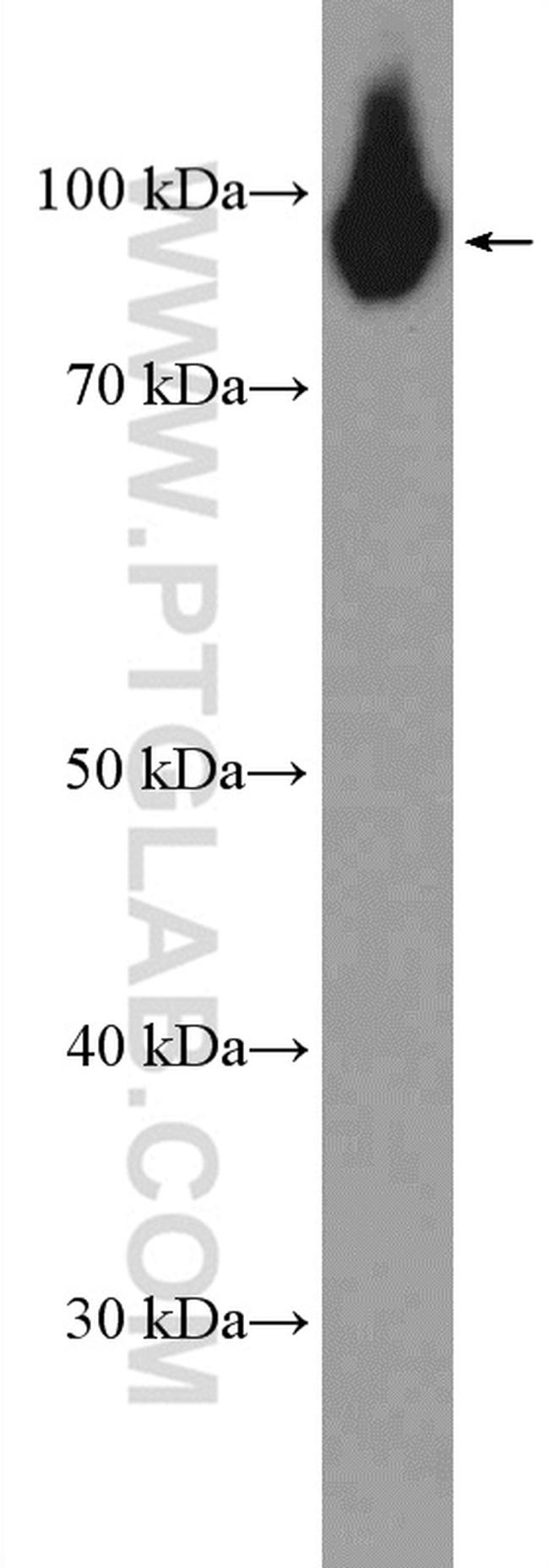 PYGB Antibody in Western Blot (WB)