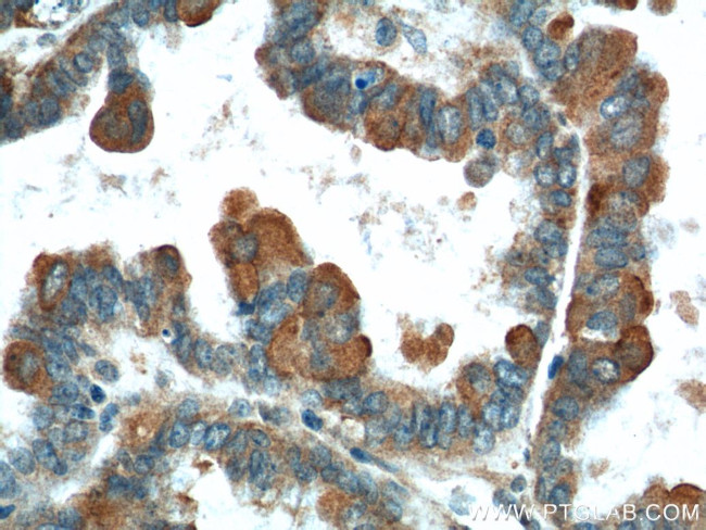 VTCN1 Antibody in Immunohistochemistry (Paraffin) (IHC (P))