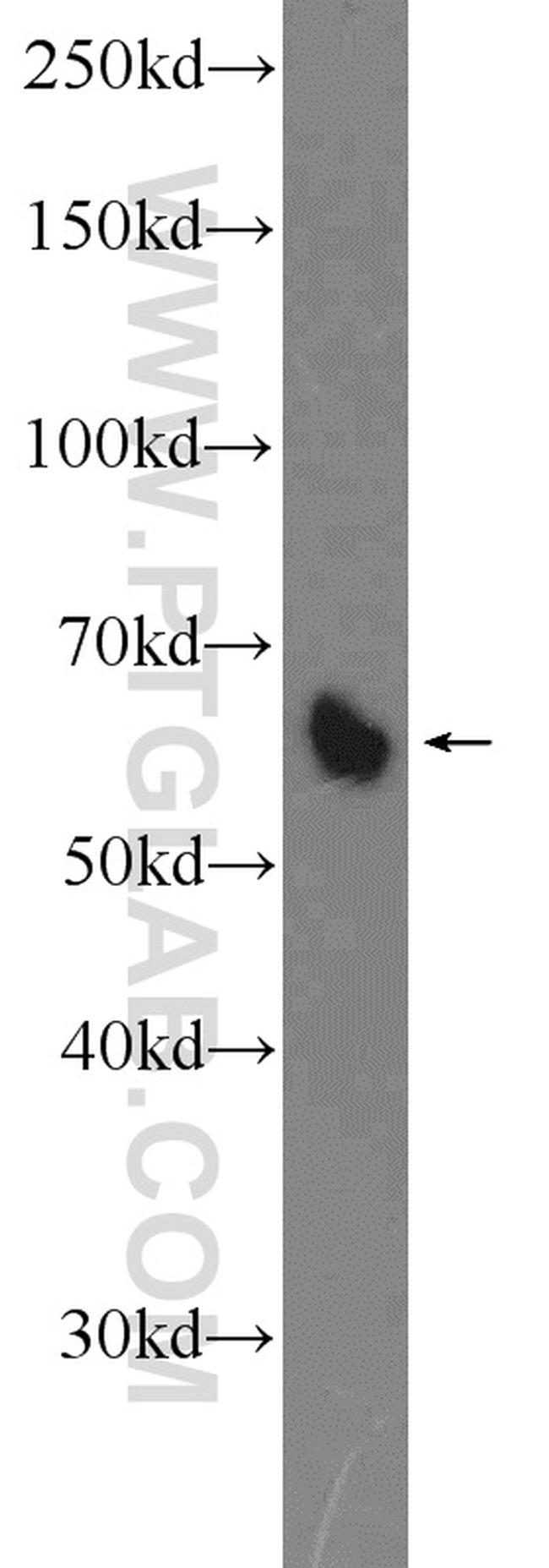 VTCN1 Antibody in Western Blot (WB)