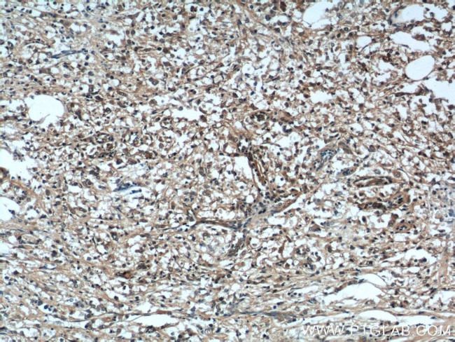 VTCN1 Antibody in Immunohistochemistry (Paraffin) (IHC (P))