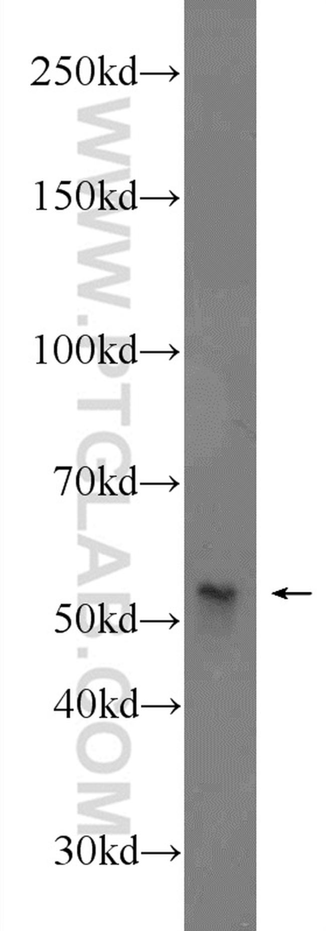 VTCN1 Antibody in Western Blot (WB)