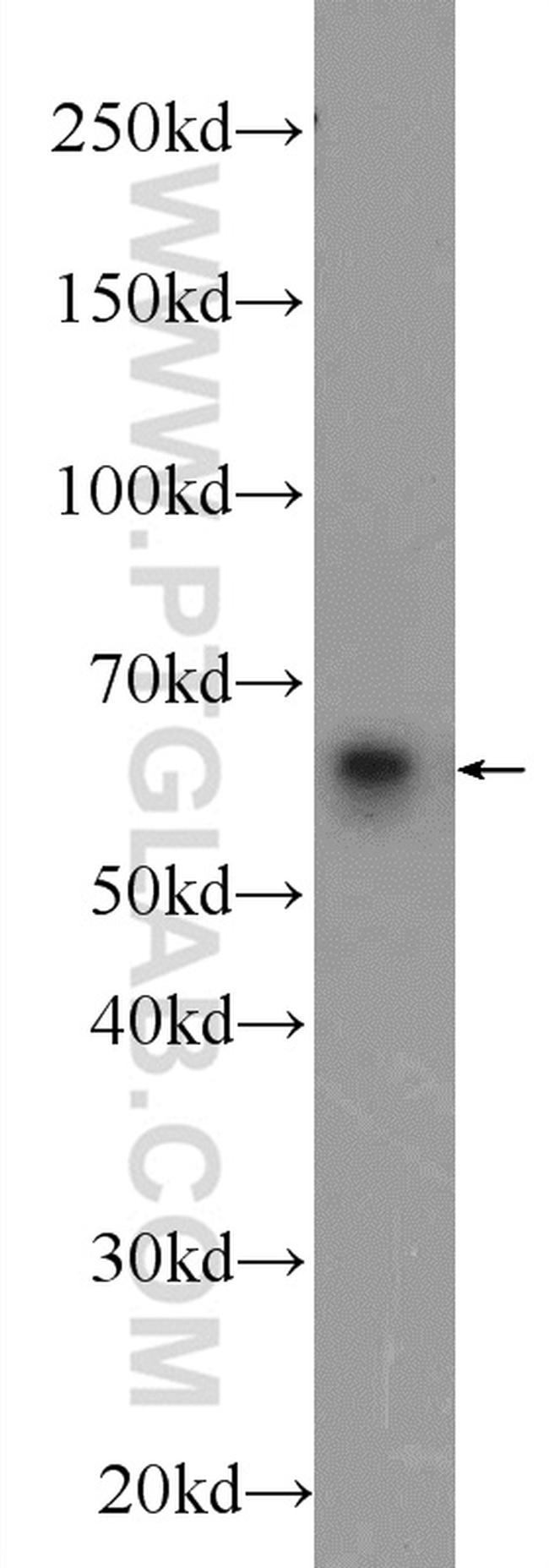 VTCN1 Antibody in Western Blot (WB)