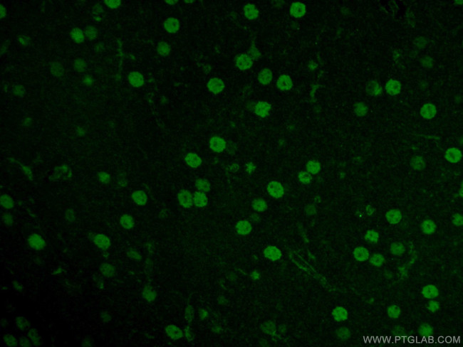 NEUROD1 Antibody in Immunohistochemistry (PFA fixed) (IHC (PFA))