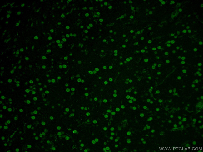 NEUROD1 Antibody in Immunohistochemistry (PFA fixed) (IHC (PFA))