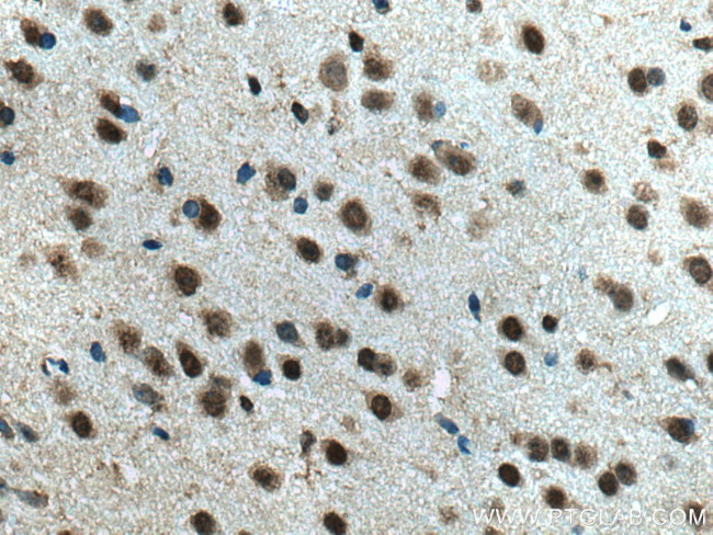 NEUROD1 Antibody in Immunohistochemistry (Paraffin) (IHC (P))