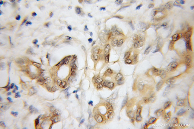 NEUROD1 Antibody in Immunohistochemistry (Paraffin) (IHC (P))