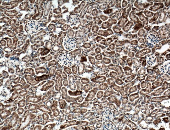 SLC25A10 Antibody in Immunohistochemistry (Paraffin) (IHC (P))