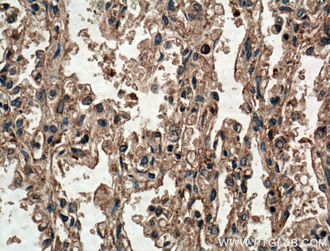 SLC25A10 Antibody in Immunohistochemistry (Paraffin) (IHC (P))