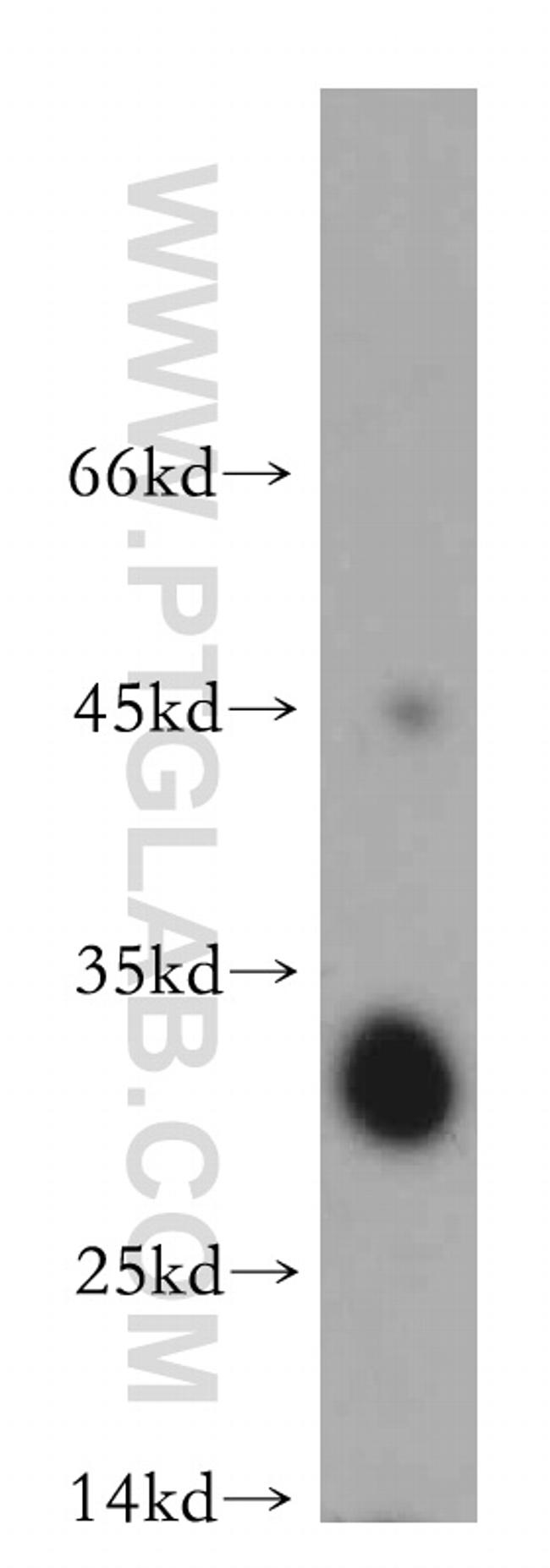 SLC25A10 Antibody in Western Blot (WB)