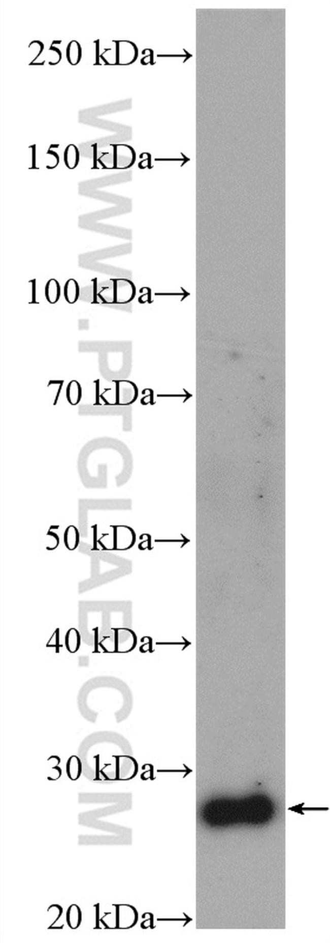 SLC25A10 Antibody in Western Blot (WB)