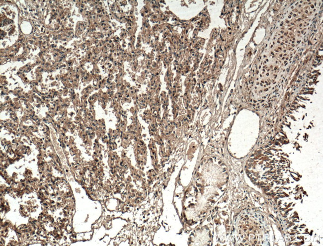 SLC25A10 Antibody in Immunohistochemistry (Paraffin) (IHC (P))