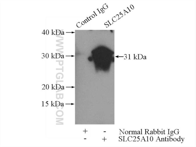 SLC25A10 Antibody in Immunoprecipitation (IP)