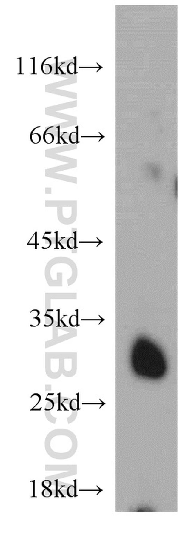 SLC25A10 Antibody in Western Blot (WB)