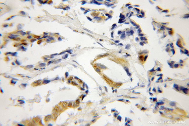 CDA1 Antibody in Immunohistochemistry (Paraffin) (IHC (P))