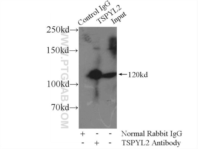 CDA1 Antibody in Immunoprecipitation (IP)