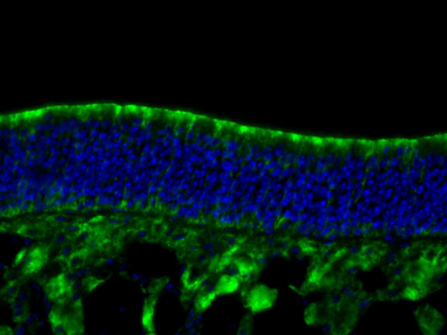 REEP6 Antibody in Immunocytochemistry (ICC/IF)