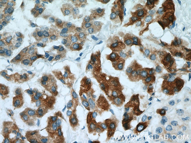 REEP6 Antibody in Immunohistochemistry (Paraffin) (IHC (P))