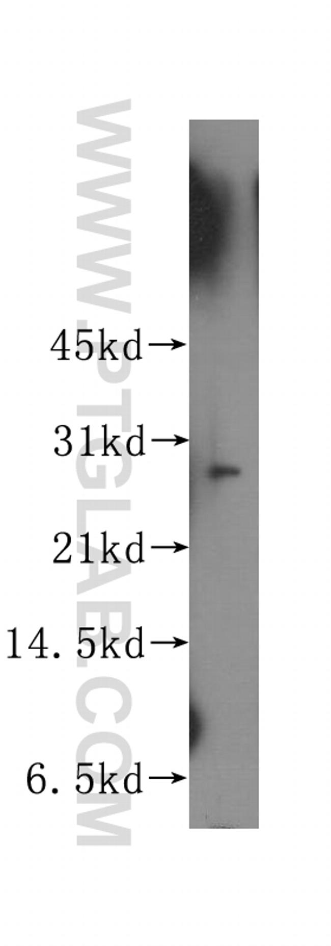 APIP Antibody in Western Blot (WB)