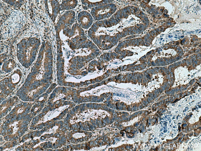 UBA5 Antibody in Immunohistochemistry (Paraffin) (IHC (P))