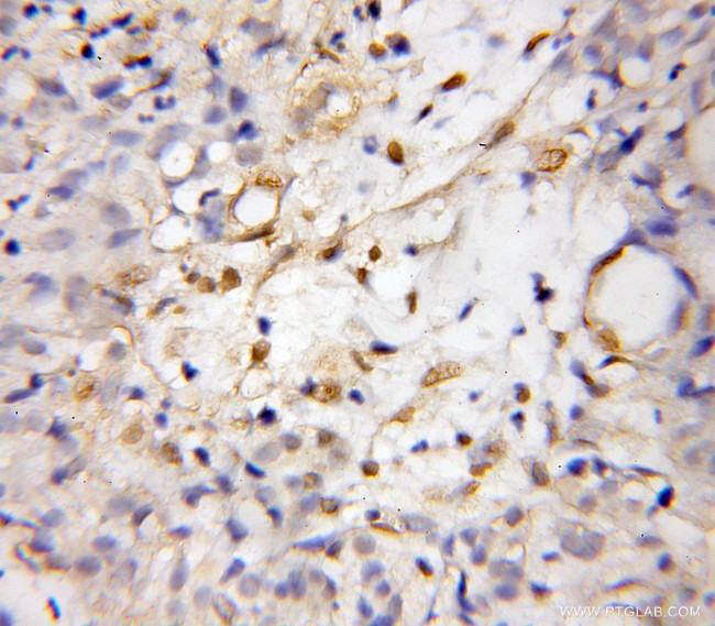 DDIT4L Antibody in Immunohistochemistry (Paraffin) (IHC (P))