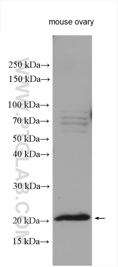 DDIT4L Antibody in Western Blot (WB)